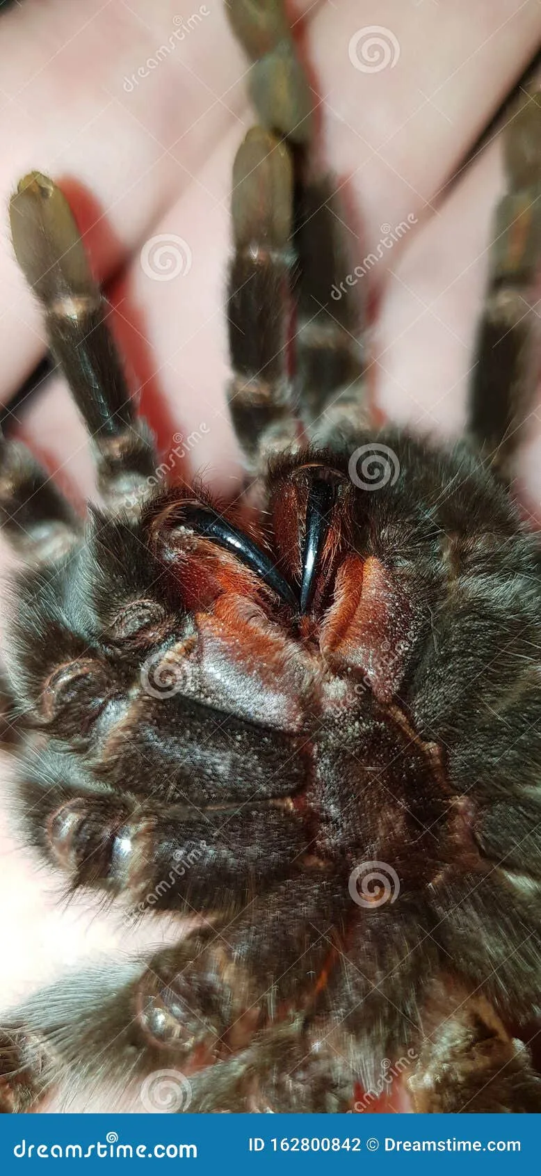 18029 tarantula injury
